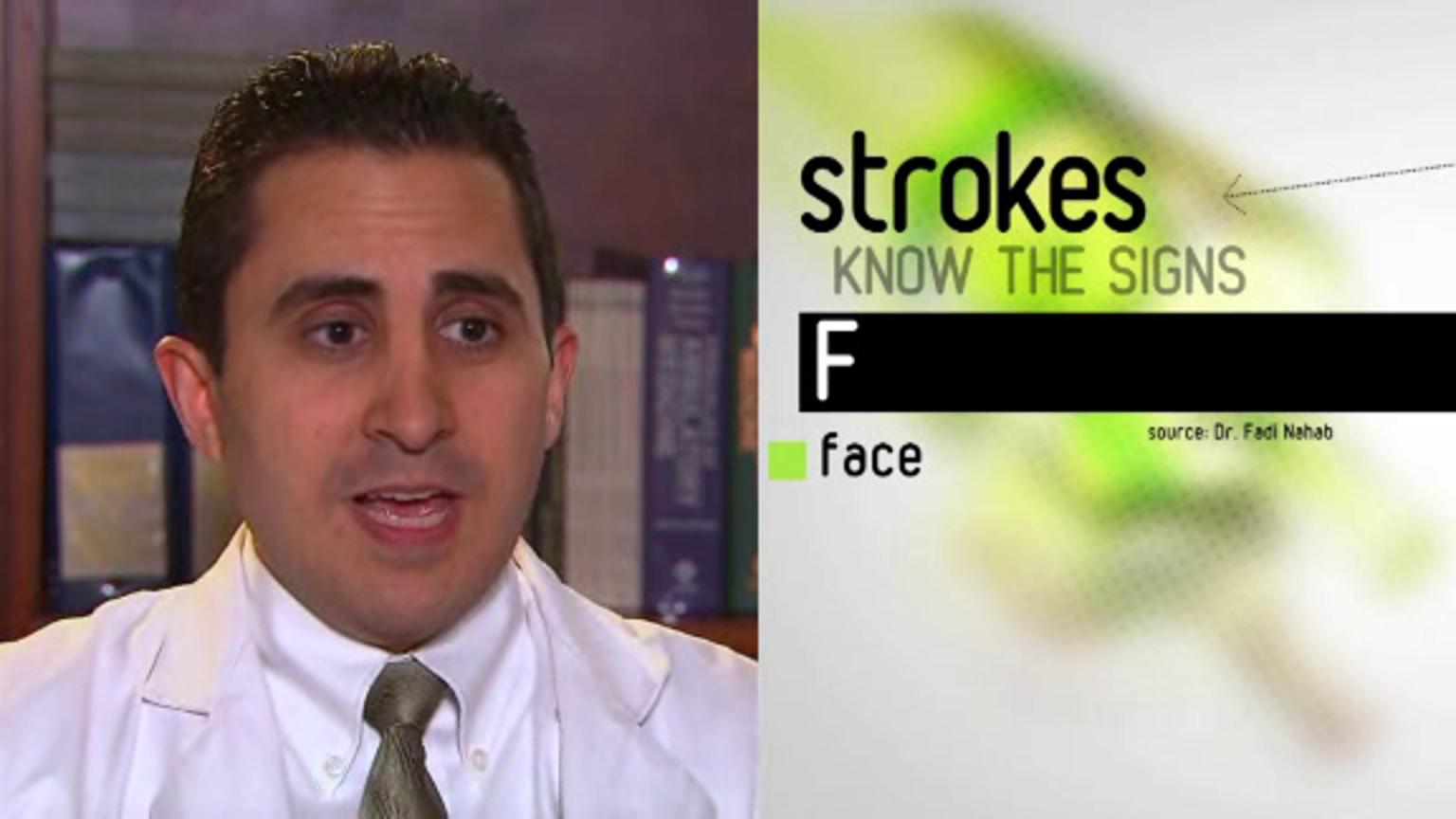 stroke-what-it-is-causes-symptoms-treatment-types