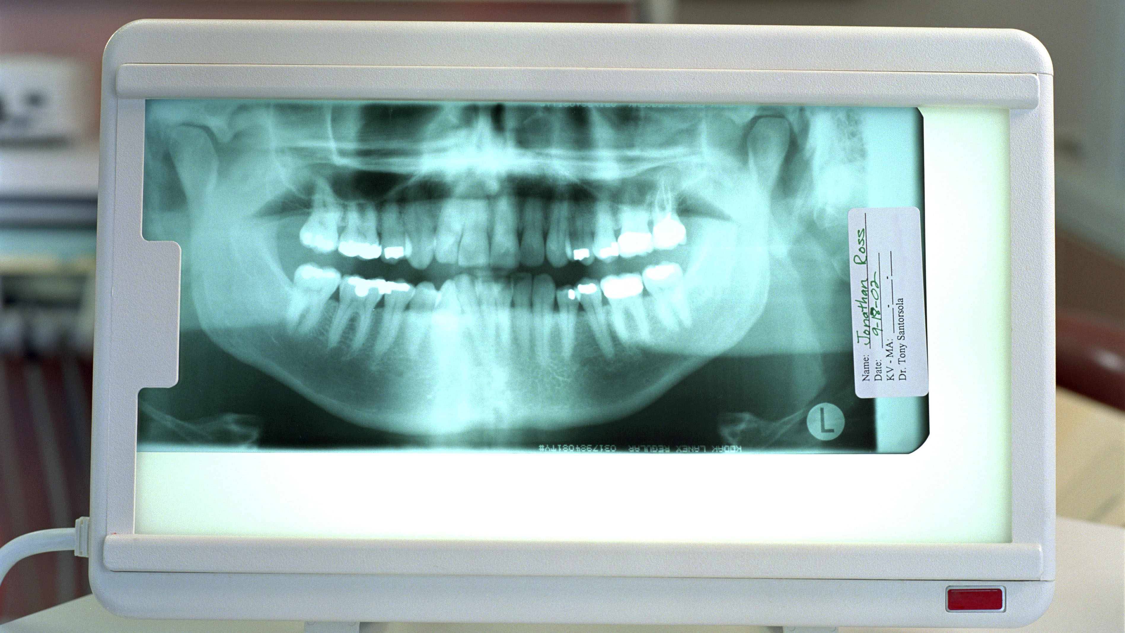 Рентген полости рта с молочными