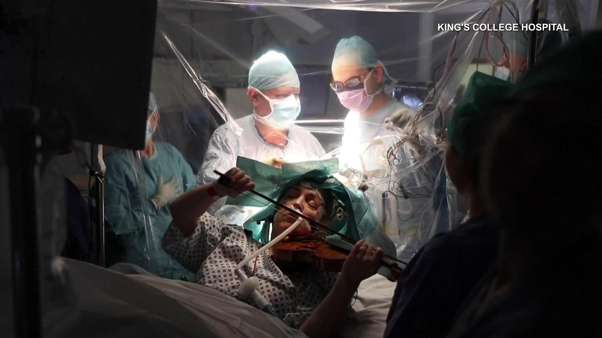 UK patient plays violin during unusual brain surgery CityNews Toronto