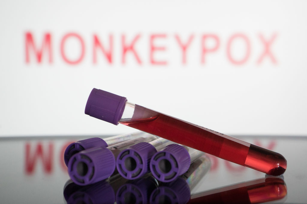 Blood test vials are seen in front of a screen that says "monkeypox"