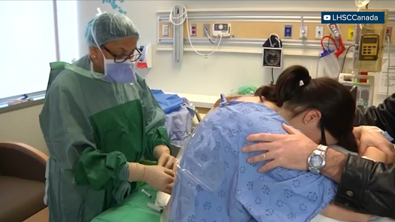 Pregnant people facing challenges with epidural catheter, health care staff shortages