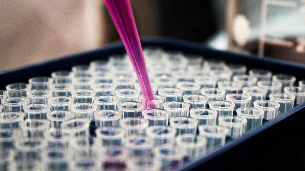 Test tubes in a lab